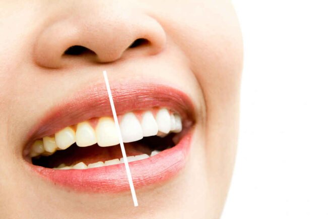¿El Café Mancha Los Dientes? ¿El Café Mancha Los Dientes?